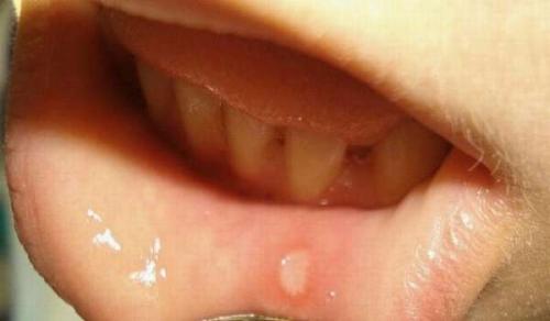 Чем полезны семечки для мужчин. Семечки подсолнуха польза и вред для мужчин