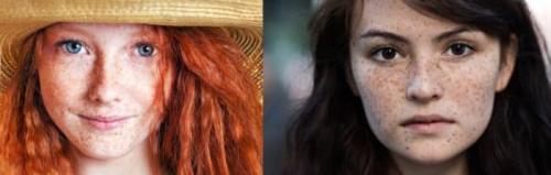 Как убрать возрастные пигментные пятна. Старческие пятна на лице: лечение 04