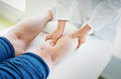 5 простых способов укрепить сосуды. Как укрепить сердечно-сосудистую систему продуктами питания? 01