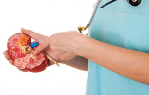 Капуста квашеная при заболевании почек. Лечебное питание при мочекаменной болезни 01