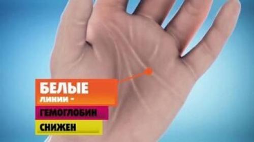 Топ-5 продуктов для хорошего гемоглобина. Тонкости повышения гемоглобина 02