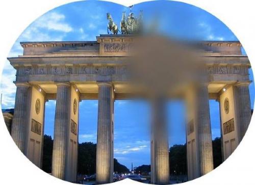 Новое в диагностике и лечении рассеянного склероза. Что такое рассеянный склероз и какие формы он принимает 02