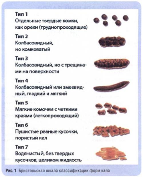 О чем говорит ваш кал. Признаки нездорового кала 01