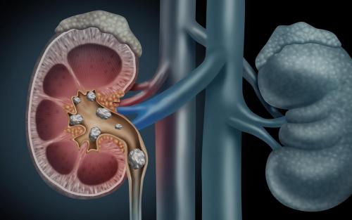Как заготовить корни подсолнуха для лечения. Сбор корня: правила заготовки, сушки и хранения 03