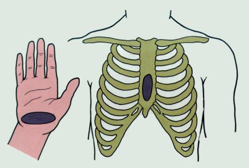 Реанимация ели. Что такое сердечно-легочная реанимация и как правильно ее провести