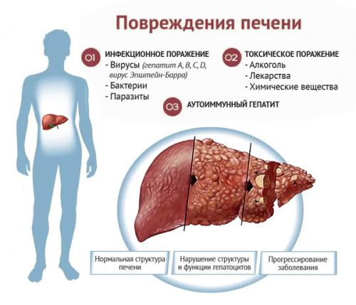 Что нельзя делать при больной печени. Общие правила