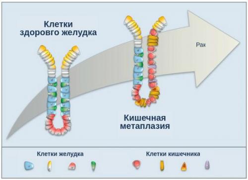 Как восстановить защитные свойства желудка.. Изменения в образе жизни 04 Как восстановить защитные свойства желудка.. Изменения в образе жизни 04